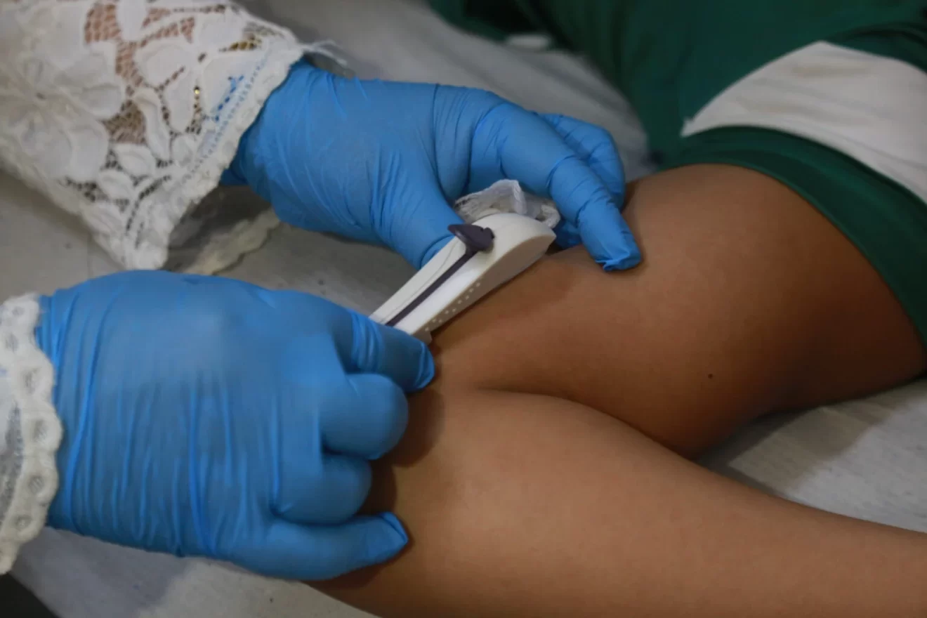 Fortaleza dá anticoncepcional para meninas a partir dos 10 anos