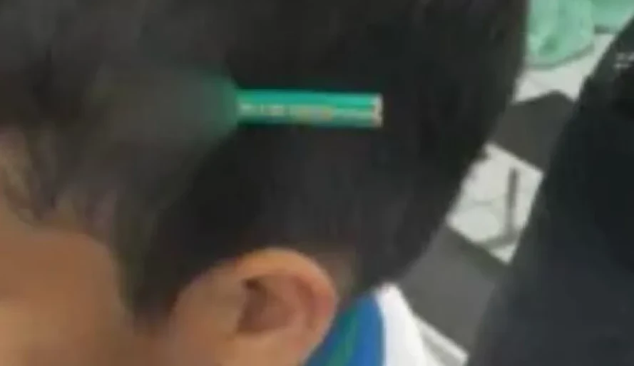 Aluno crava lápis na cabeça de colega durante briga em escola