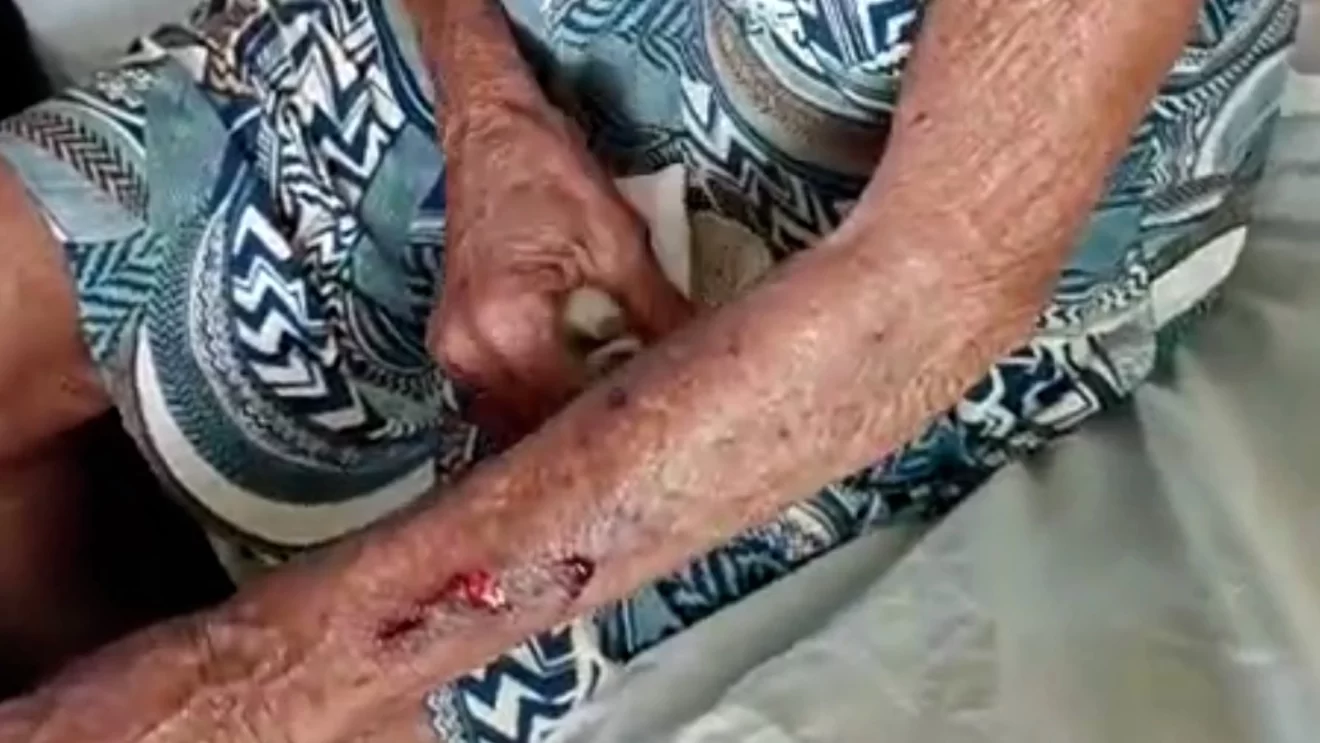 Homem tenta estuprar e agride idosa, de 79 anos, que pescava na zona rural de Codó