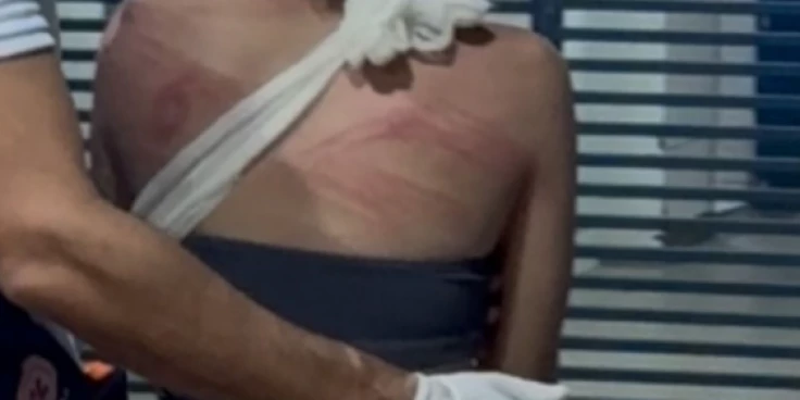 Uma adolescente foi espancada dentro do cemitério Jardim das Rosas, no bairro Vilinha, em Imperatriz, para onde ela foi atraída. Duas adolescentes praticaram as agressões incentivadas por um grupo de cerca de 10 pessoas presentes no local na noite dessa quinta-feira (16). Clique aqui para seguir o canal do Imirante no WhatsApp Polícia identifica quatro homens Com base em imagens de câmeras de segurança, a polícia identificou quatro homens com passagens pela polícia. Adolescente consegue se livrar de agressores Com a chegada da Força Tática ao cemitério, os suspeitos fugiram, e a adolescente conseguiu correr, bastante machucada, após ser agredida com facão e pauladas. Ela foi encaminhada ao Hospital Municipal com suspeita de fratura. A polícia segue à procura dos criminosos. A motivação do crime seria o furto de um celular, de acordo com informações policiais.