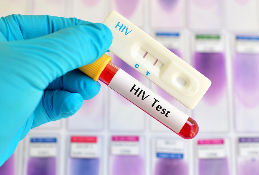 São Luís registra uma das maiores taxas de detecção de HIV do país