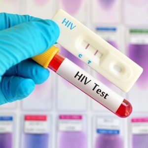 São Luís registra uma das maiores taxas de detecção de HIV do país