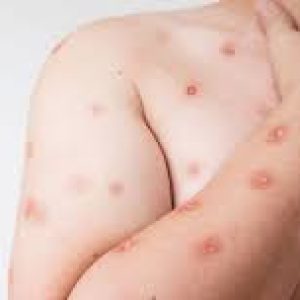 Ministério da Saúde/Reprodução